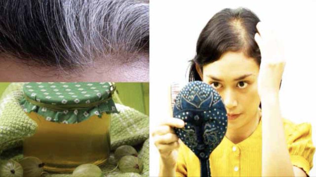 झड़ते बालों की वजह से बढ़ रहा है गंजापन तो ये तिब्बती आयुर्वेदिक नुस्खा दे सकता है राहत | Boldsky