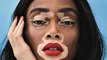 Atteinte de vitiligo, elle devient top model malgré les réactions des gens
