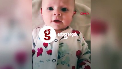 İşitme engelli bebek, özel cihaz sayesinde ilk kez annesinin sesini duydu