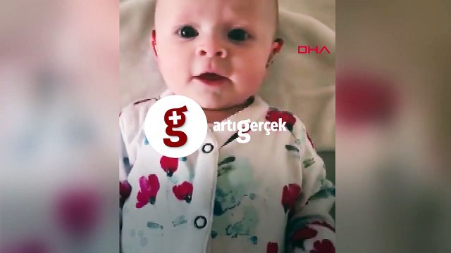 İşitme engelli bebek, özel cihaz sayesinde ilk kez annesinin sesini duydu