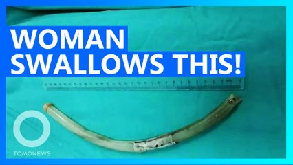 Chinese woman swallows a massive tube
