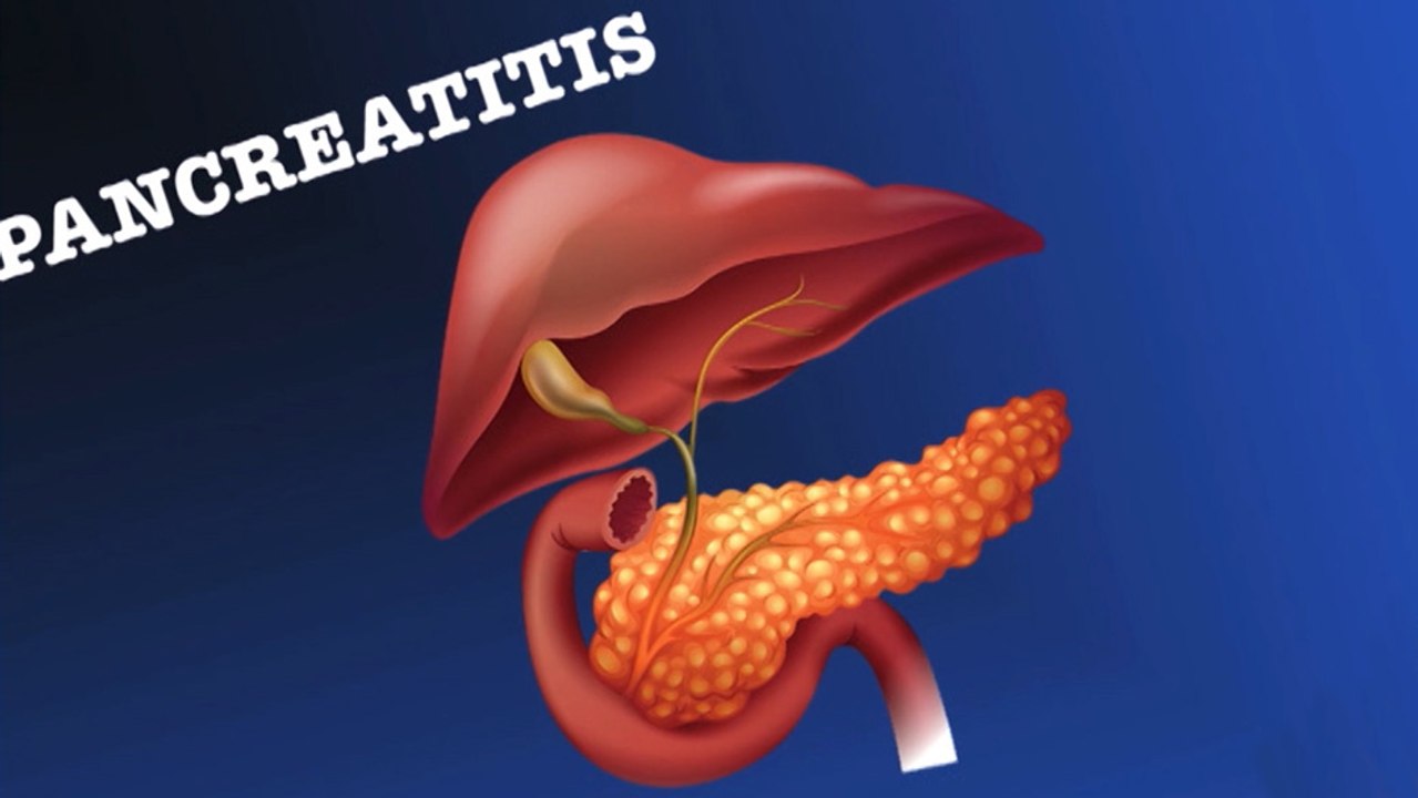 bd-complicaciones-de-pancreatitis-101219