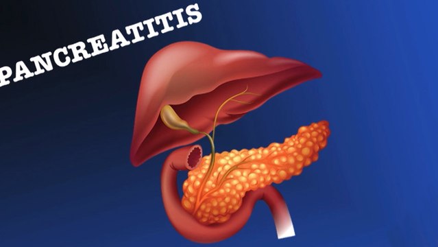bd-complicaciones-de-pancreatitis-101219