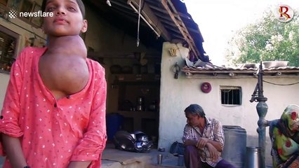 Rare disease leaves 12-year-old girl in India with 'football-sized' tumour on her neck