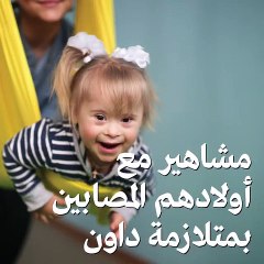 مشاهير مع أولادهم المصابين بمتلازمة داون