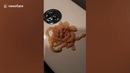 Thai man horrified after pulling a giant, moving tapeworm out of his backside