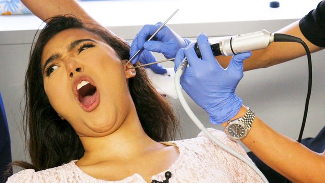 How earwax is professionally extracted