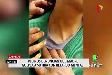 Zapallal: Denuncian que joven con discapacidad es constantemente golpeada por su madre