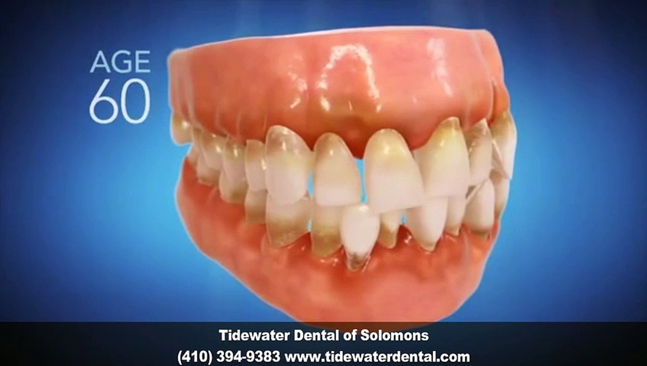 Invisalign Dentist Solomons MD