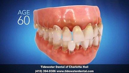 Invisalign Dentist Charlotte Hall MD