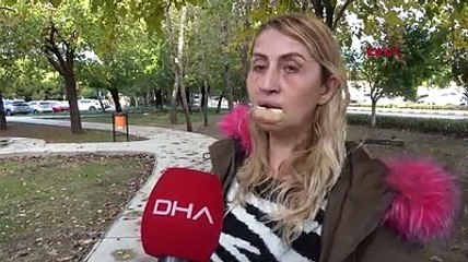 Dolgu operasyonundan sonra çürümeye başlayan dudağını kaybetti; uygulama yapan doktorların KBB uzmanı olduğunu öğrendi