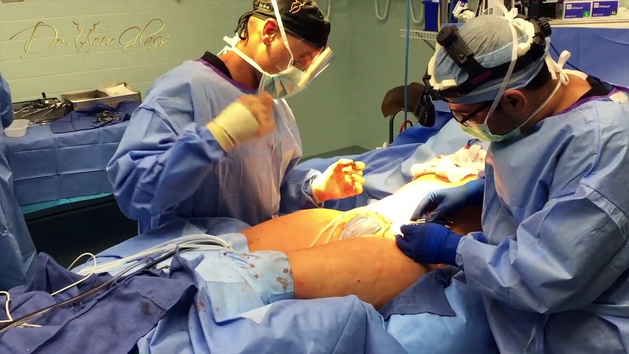 Is plastic surgery better before or after pregnancy