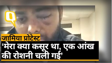 जामिया के छात्र का आरोप, पुलिस की लाठी ने छीनी आंखों की रोशनी