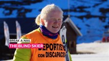 Break a Nail: This fearless teen skier doesn't believe in limitations