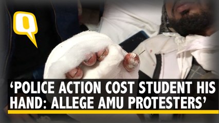 ‘Shell Exploded in My Hand’: Injured AMU Students on Police Action