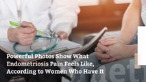 Powerful Photos Show What Endometriosis Pain Feels Like, According to Women Who Have It