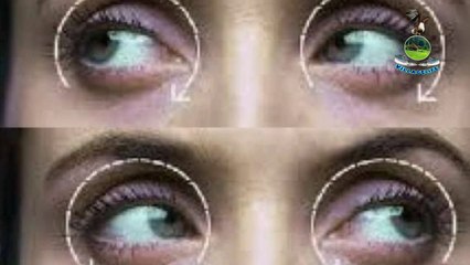 eye health tips in malayalam വ്യായാമം കണ്ണിനും നൽകൂ... ആരോഗ്യം സംരക്ഷിക്കൂ...