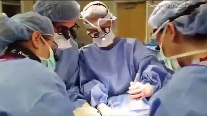 Este hombre se cortó un pulgar por accidente y lo reemplazó por el dedo de su propio pie