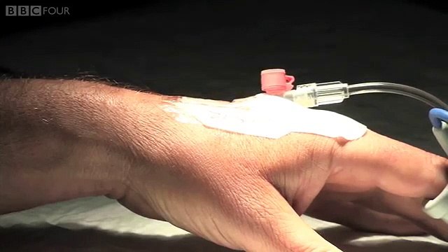 Michael Mosley takes the 'truth drug' thiopental - Pain, Pus and Poison - BBC Four