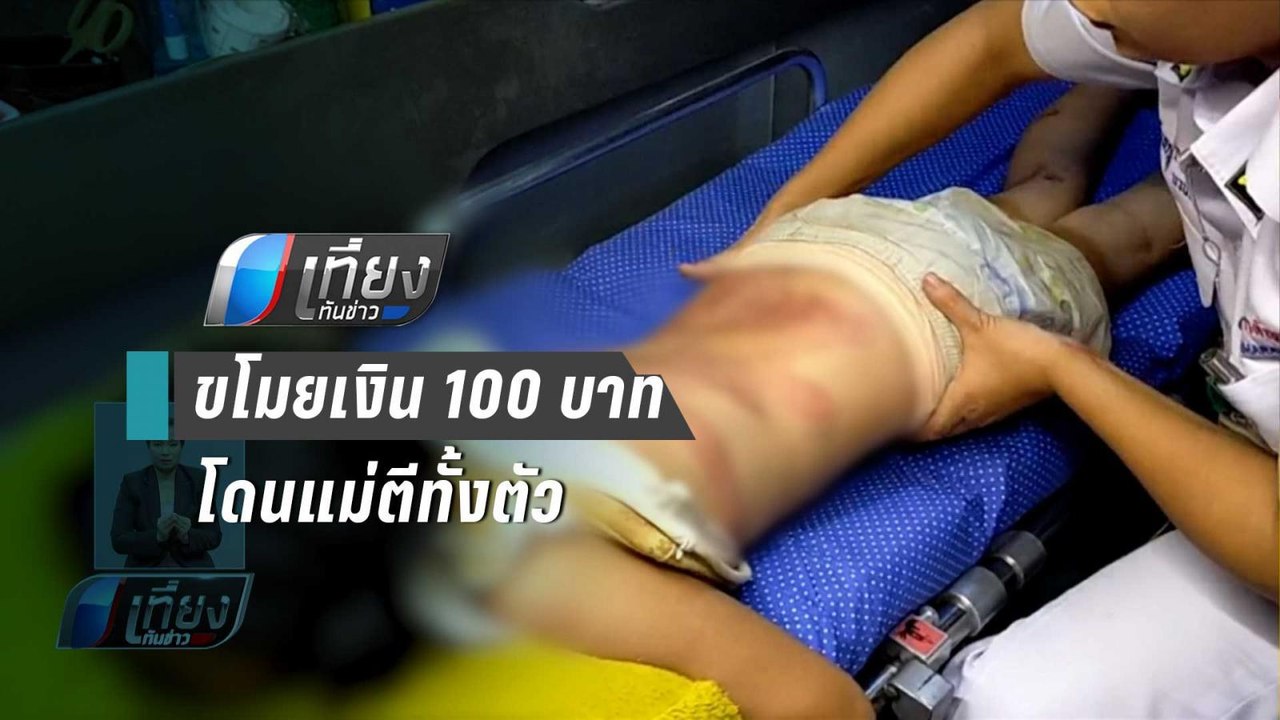 ดญ.วัย 10 ขวบเดินขอความช่วยเหลือ หลังถูกแม่ตีทั้งตัว | เที่ยงทันข่าว