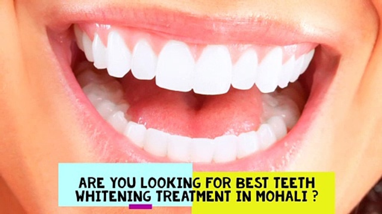 Best Teeth Whitening Treatment In Mohali Video Dailymotion