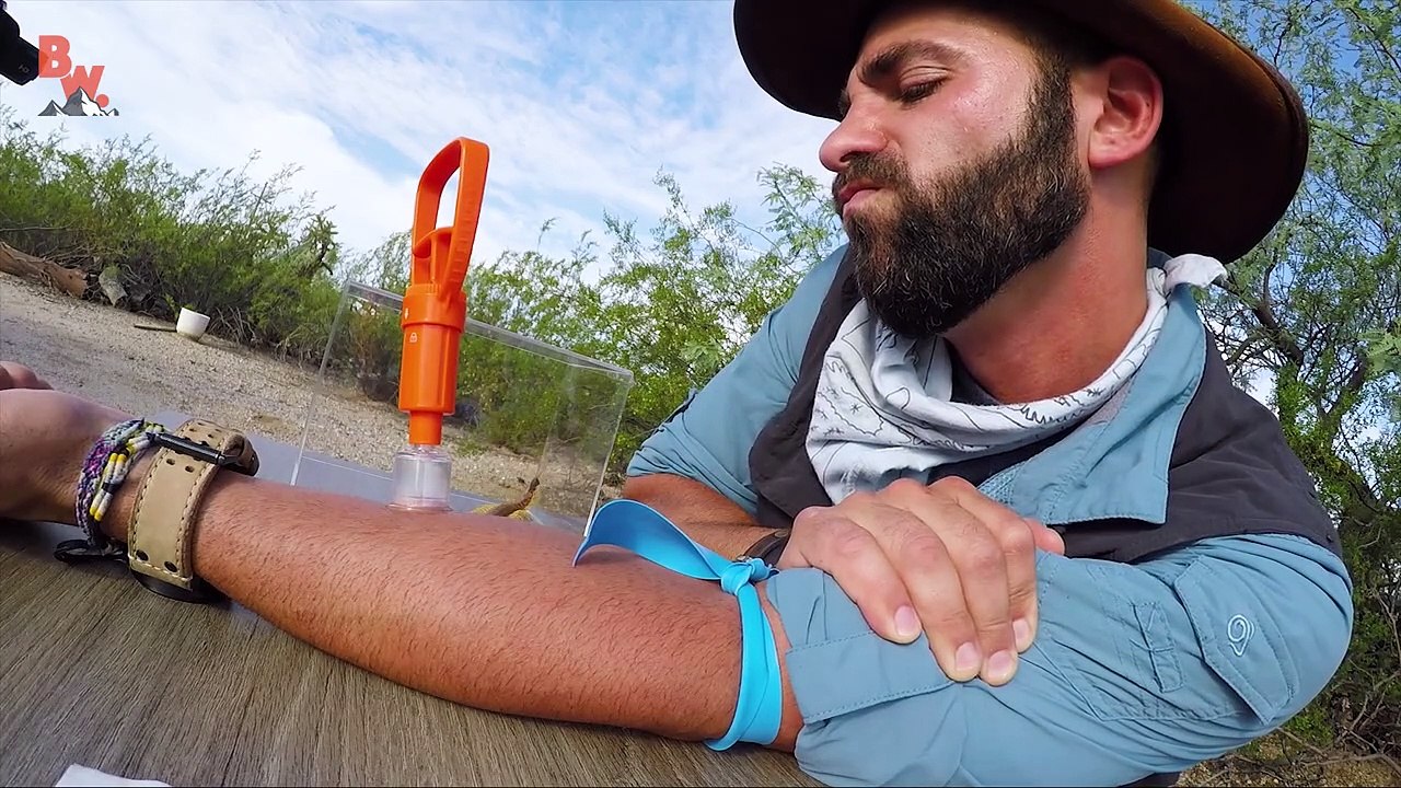 VENOM EXTRACTION - Centipede Bite Aftermath!