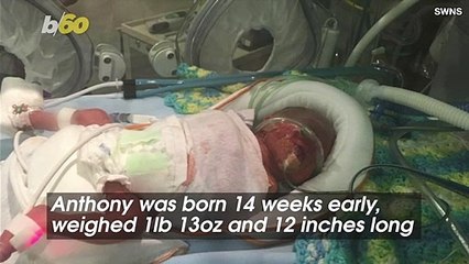 "Medical Marvel" Baby Walks Just in Time For Christmas