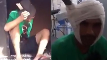 Este preso tiene un machete clavado en la cabeza y ni se queja