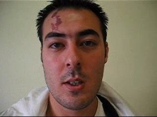 Burak ERMIS s'adresse à la communauté turque