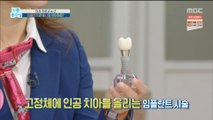 [HEALTHY] The difference between implants' and 'false teeth' is?, 기분 좋은 날 20191226