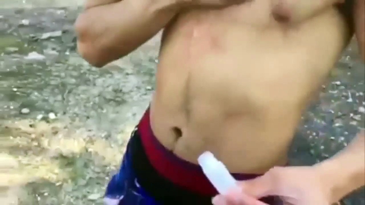 Esto es lo que pasa cuando eres tonto y te pegas pegamento extra fuerte en el pecho