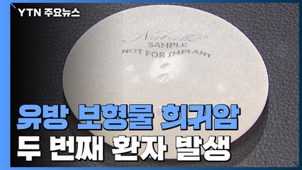 '유방 보형물 희귀암' 두 번째 환자 발생 / YTN
