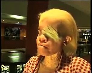 Oscar winner Lupita Nyong'o "In My Genes" Documentary on Albinism Trailer