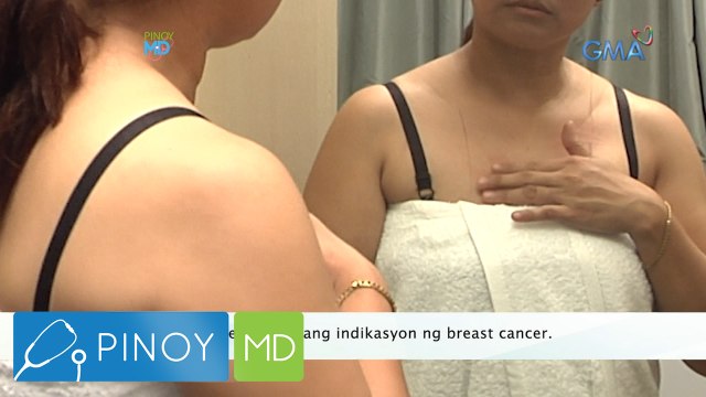 Pinoy MD: Radiation therapy, mainam ba para sa lahat ng may sakit na breast cancer?