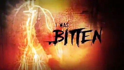 I Was Bitten Grizzly Bear Attack