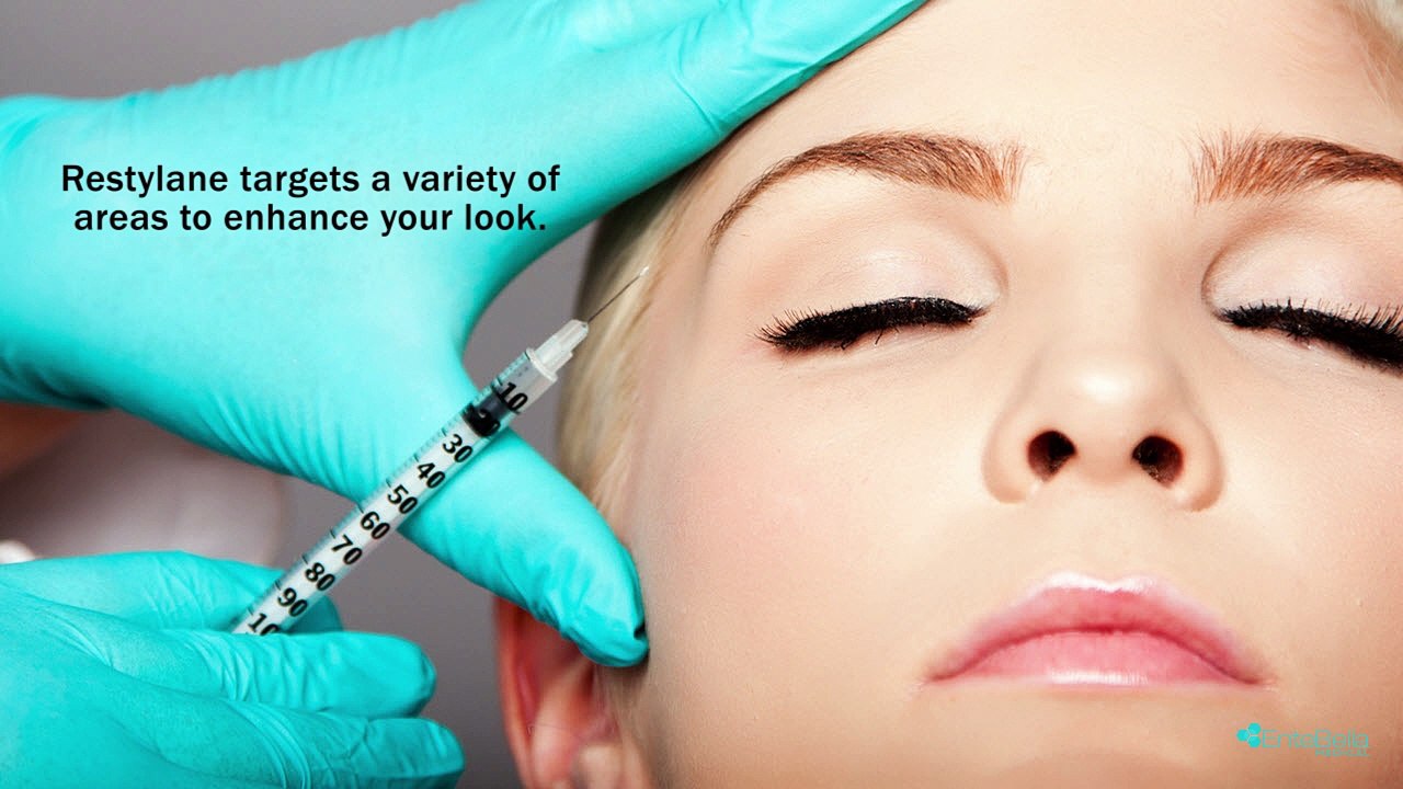 Why Should You Opt For a Restylane Treatment