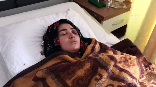 Eşi tarafından darbedilen kadın: 'Hayatımdan tamamen çıksın istiyorum' - SAMSUN