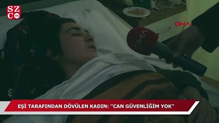 Eşi tarafından dövülen kadın: Can güvenliğim yok!