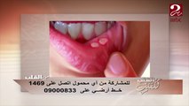 الدكتور مدحت خليل : بداية علاج السكري تبدأ من الحفاظ على الفم