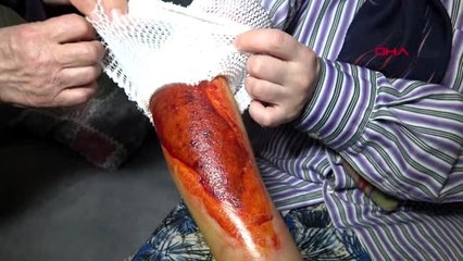 Karabük "misafiri yalnız bıraktın" diyerek eşinin koluna çaydanlıktaki suyu döktü