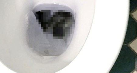 Klozet kapağını açan şahıs, gördüğü manzara karşısında hayatının şokunu yaşadı! Derhal telefonuna sarıldı