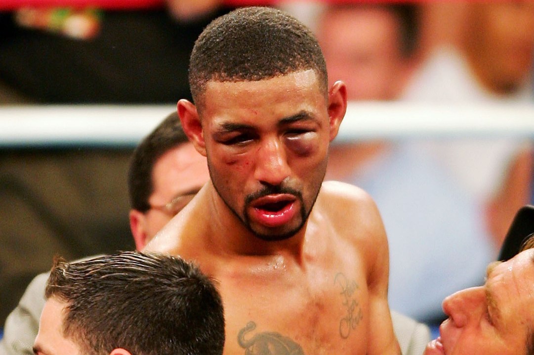 Diego 'Chico' Corrales: Increible lo que hacía este boxeador