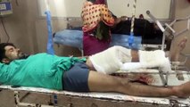 उज्जैन एनकाउंटर में घायल बदमाश इलाज के लिए इंदौर रैफर