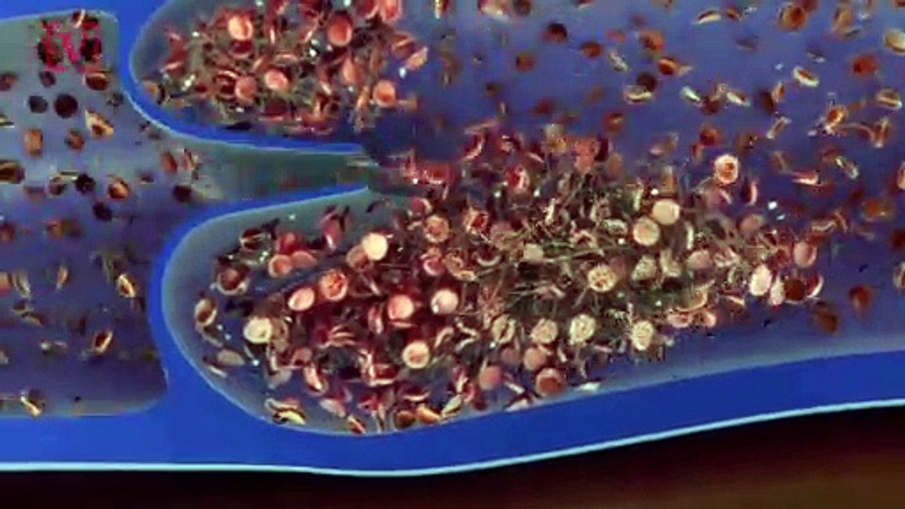 Astronaut’s Blood Clot Treated from Earth