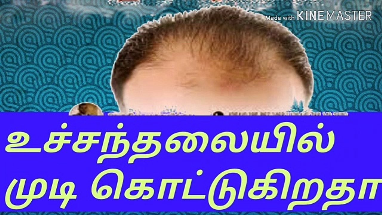 உச்சன் தலையில் முடிகொட்டுகிறதா?/நல்லதைமட்டும்சொள்வோம்/ஜோஷியர்வெற்றிவடிவேல்/ஜோதிடர்வெற்றிவடிவேல்/