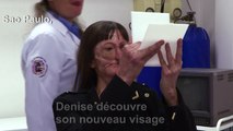 Au Brésil, smartphone et silicone pour reconstruire un visage