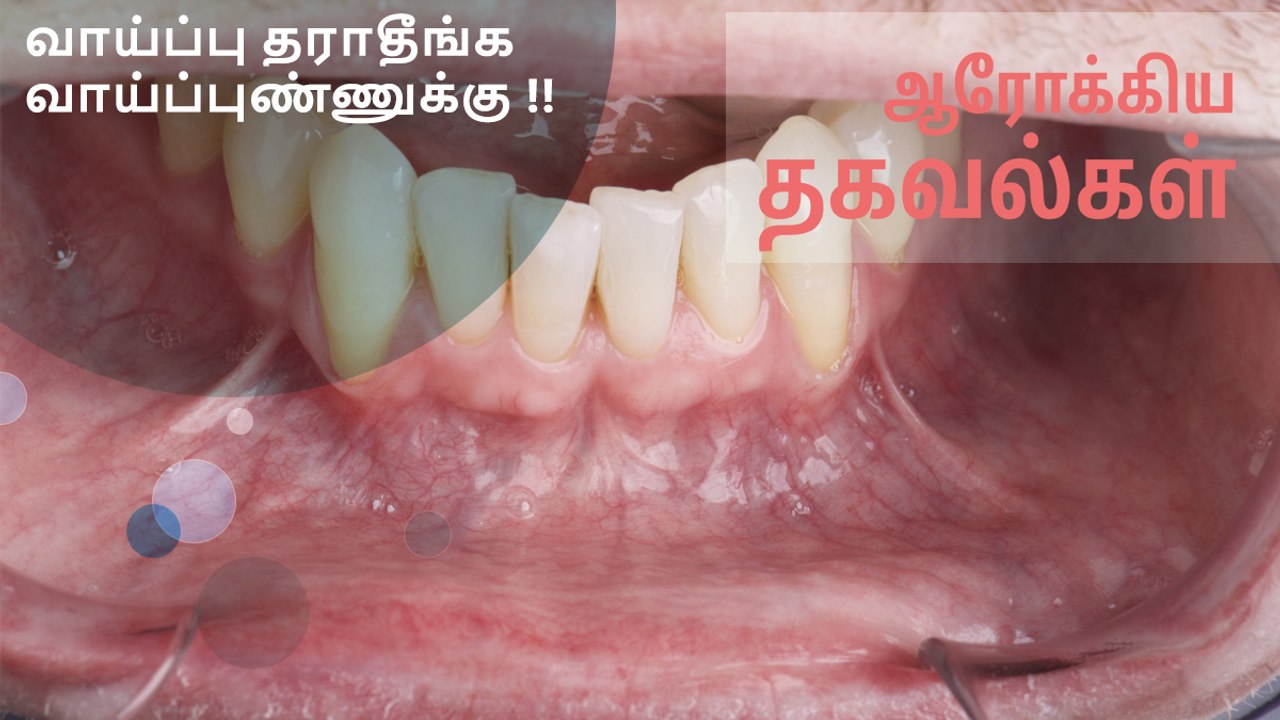 வாய்ப்பு தராதீங்க வாய்ப்புண்ணுக்கு..!