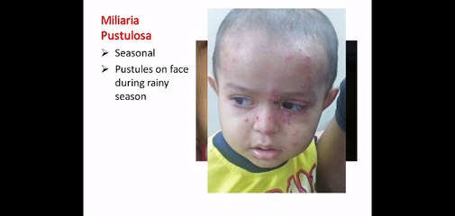 Skin problems in children and GP's Guide