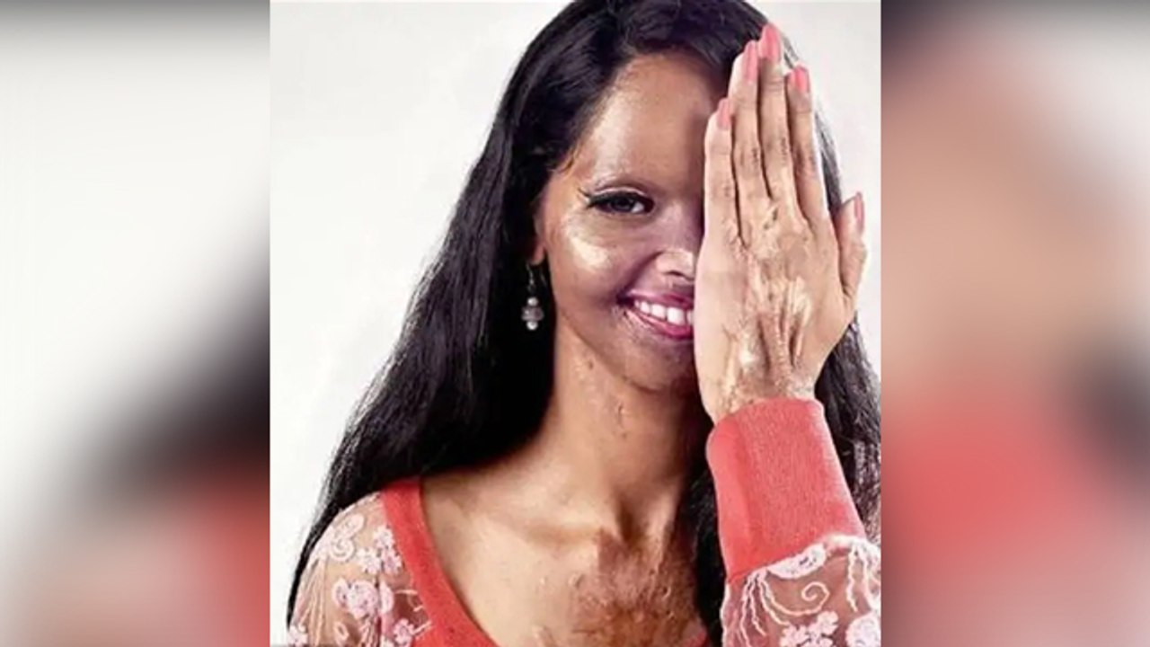 Chhapaak: देखिए Laxmi Agarwal की पूरी कहानी | FilmiBeat