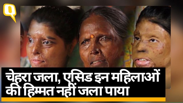 Acid Attack Survivor |_एसिड से चेहरा जल सकता है, हिम्मत नहीं, इन महिलाओं से सुनिए